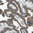 Immunohistochemical staining of human placenta shows strong granular cytoplasmic positivity in trophoblastic cells.