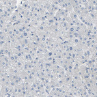 Immunohistochemical staining of human liver shows no positivity in hepatocytes as expected.