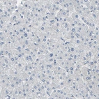 Immunohistochemical staining of human liver shows no positivity in hepatocytes as expected.