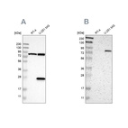 Western blot analysis using Anti-ALDH18A1 antibody HPA012604 (A) shows similar pattern to independent antibody HPA008333 (B).