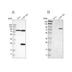 Western blot analysis using Anti-ALDH18A1 antibody HPA012604 (A) shows similar pattern to independent antibody HPA008333 (B).