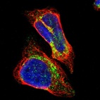Immunofluorescent staining of human cell line A-431 shows localization to mitochondria.