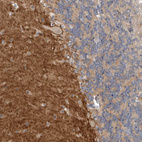 Immunohistochemical staining of human cerebellum shows positivity in neuropil.