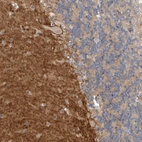 Immunohistochemical staining of human cerebellum shows positivity in neuropil.