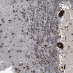 Immunohistochemical staining of human cerebellum shows strong cytoplasmic positivity in purkinje cells.