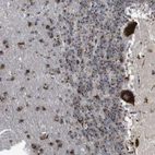 Immunohistochemical staining of human cerebellum shows strong cytoplasmic positivity in purkinje cells.
