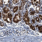 Immunohistochemical staining of human stomach shows strong cytoplasmic positivity in glandular cells.
