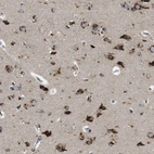 Immunohistochemical staining of human cerebral cortex shows strong cytoplasmic positivity in neurons.