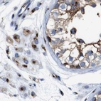 Immunohistochemical staining of human testis using Anti-TGOLN2 antibody HPA012609.