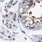 Immunohistochemical staining of human testis using Anti-TGOLN2 antibody HPA012609.