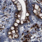 Immunohistochemical staining of human colon using Anti-TGOLN2 antibody HPA012609.