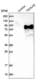 Western blot analysis in control (vector only transfected HEK293T lysate) and TGOLN2 over-expression lysate (Co-expressed with a C-terminal myc-DDK tag (~3.1 kDa) in mammalian HEK293T cells, LY401942).