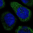 Immunofluorescent staining of human cell line A-431 shows localization to cytosol.