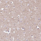 Immunohistochemical staining of human cerebral cortex shows moderate positivity in neuronal processes in neuropil.