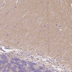 Immunohistochemical staining of human cerebellum shows weak cytoplasmic positivity in cells in molecular layer.