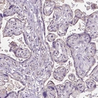 Immunohistochemical staining of human placenta shows no positivity in trophoblastic cells as expected.