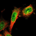 Immunofluorescent staining of human cell line U-251 MG shows localization to nucleoplasm & nuclear membrane.