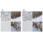 Immunohistochemical staining of human colon, esophagus, liver and tonsil using Anti-DSC2 antibody HPA012615 (A) shows similar protein distribution across tissues to independent antibody HPA011911 (B).