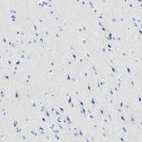 Immunohistochemical staining of human cerebral cortex shows no positivity in neurons as expected.