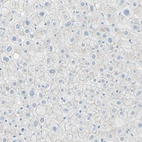 Immunohistochemical staining of human liver shows weak membranous positivity in hepatocytes.