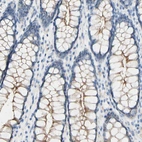 Immunohistochemical staining of human colon shows moderate membranous positivity in glandular cells.