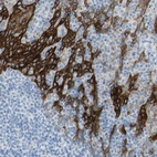 Immunohistochemical staining of human tonsil shows strong membranous positivity in squamous epithelial cells.
