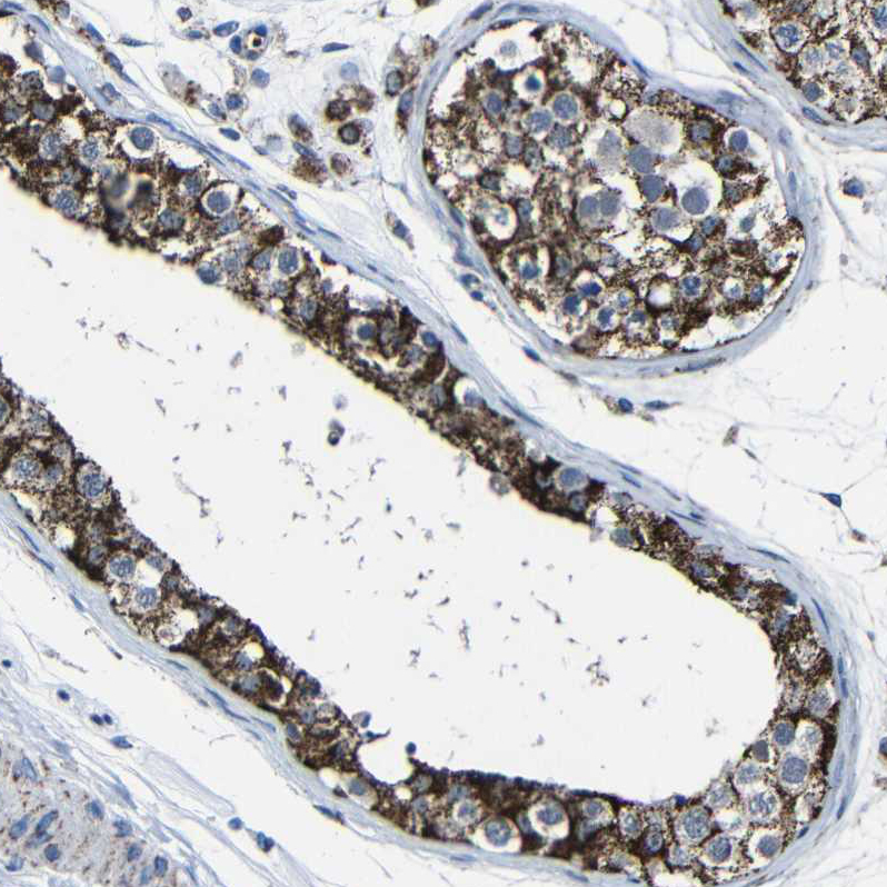 Anti-CA5B Antibody