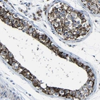 Anti-CA5B Antibody
