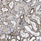 Immunohistochemical staining of human kidney shows moderate cytoplasmic positivity in cells in tubules.
