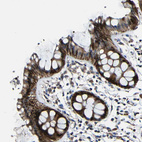 Immunohistochemical staining of human rectum shows moderate cytoplasmic positivity in glandular cells.