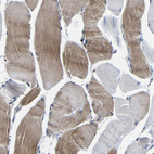 Immunohistochemical staining of human skeletal muscle shows moderate cytoplasmic positivity in myocytes.