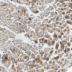 Immunohistochemical staining of human Heart muscle shows moderate granular cytoplasmic positivity in cardiomyocytes.