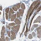 Immunohistochemical staining of human Skeletal muscle shows moderate granular cytoplasmic positivity in myocytes.