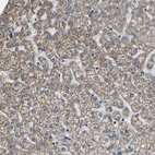 Immunohistochemical staining of human Liver shows moderate granular cytoplasmic positivity in hepatocytes.