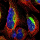 Immunofluorescent staining of human cell line U-2 OS shows localization to cytosol.