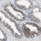 Immunohistochemical staining of human prostate shows moderate membranous positivity in glandular cells.