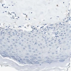 Immunohistochemical staining of human skin shows no membranous positivity in squamous epithelial cells.