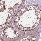 Anti-NUDT1 Antibody