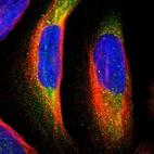 Immunofluorescent staining of human cell line U-2 OS shows localization to cytosol.