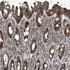 Immunohistochemical staining of human rectum shows moderate cytoplasmic positivity in glandular cells.