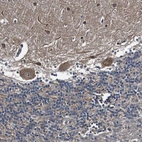 Immunohistochemical staining of human cerebellum shows moderate cytoplasmic positivity in Purkinje cells.