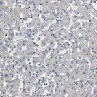 Anti-GALNT8 Antibody