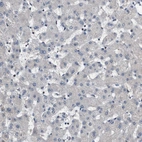 Immunohistochemical staining of human liver shows no positivity in hepatocytes as expected.