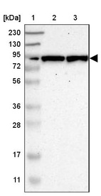 Lane 1: Marker [kDa] 230, 130, 95, 72, 56, 36, 28, 17, 11_br/_Lane 2: Human cell line RT-4_br/_Lane 3: Human cell line U-251MG sp