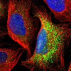 Immunofluorescent staining of human cell line U-2 OS shows localization to vesicles.
