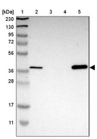 Lane 1: Marker [kDa] 230, 130, 95, 72, 56, 36, 28, 17, 11_br/_Lane 2: Human cell line RT-4_br/_Lane 3: Human cell line U-251MG sp_br/_Lane 4: Human plasma (IgG/HSA depleted)_br/_Lane 5: Human liver tissue