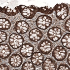 Immunohistochemical staining of human rectum shows strong cytoplasmic positivity in glandular cells.