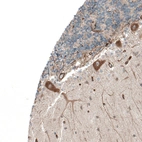 Immunohistochemical staining of human cerebellum shows moderate to strong cytoplasmic positivity in Purkinje cells.
