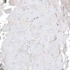 Immunohistochemical staining of human skeletal muscle shows no positivity as expected.