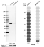 Western blot analysis in human cell lines Caco-2 and SK-MEL-30 using Anti-PAWR antibody. Corresponding PAWR RNA-seq data are presented for the same cell lines. Loading control: Anti-HDAC1.